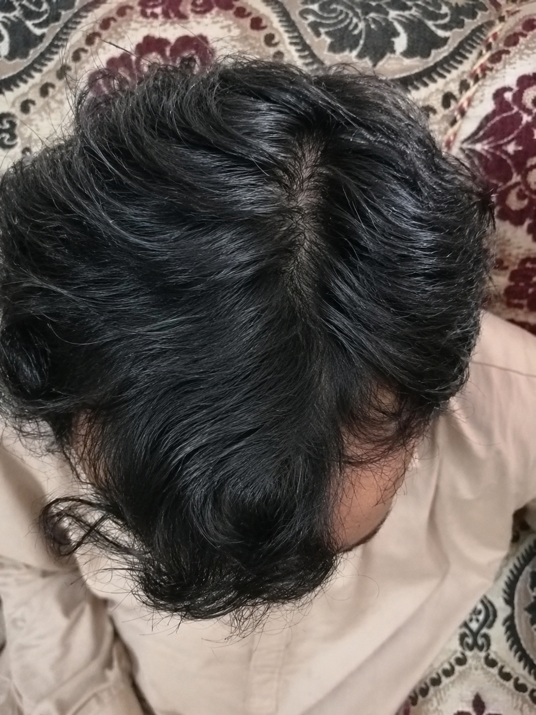 After image
