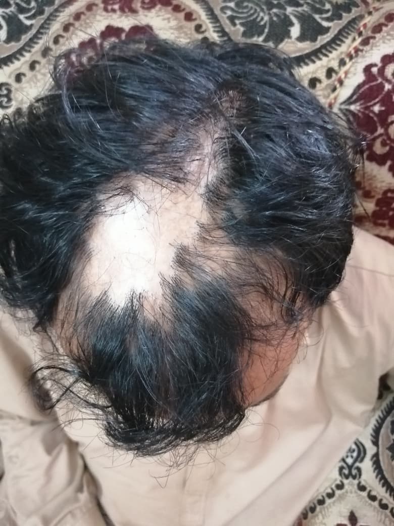 Before image