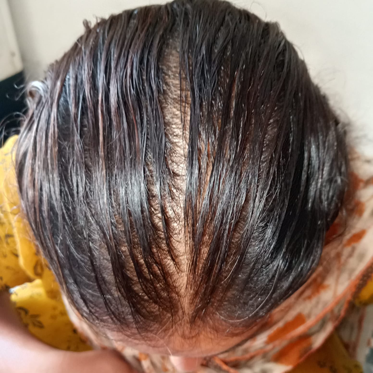 Before image